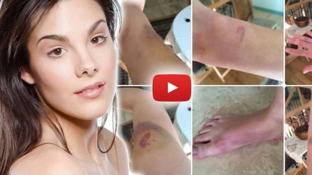 model-left-bloodied-and-bruised-after-cops-broke-into-her-home-to-rescue-her
