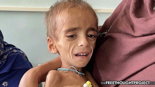 A malnourished child in Kandahar in October: BBC