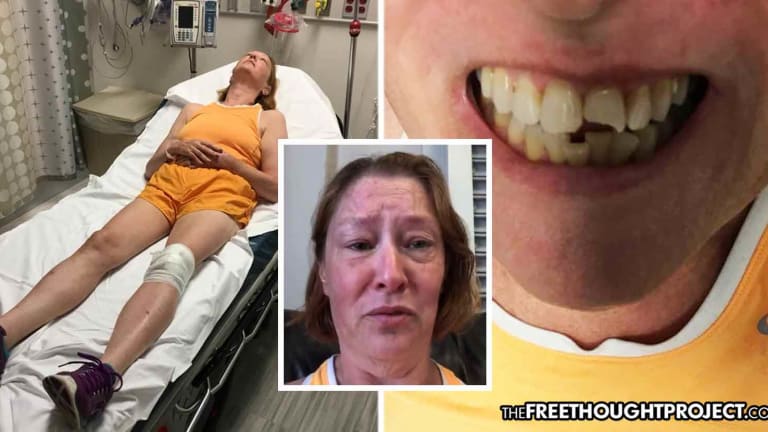 Cops Shatter 53-Year-old Woman's Teeth, Fracture Her Skull After She Tried to Film Them