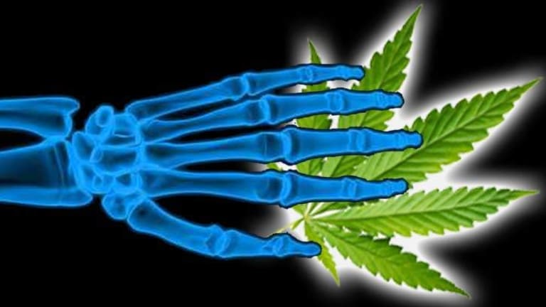 New Research Shows Cannabis Heals Broken Bones and Prevents Rejection of Transplanted Organs