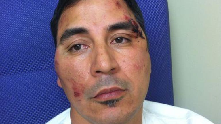 Cops Beat This Father of Three to the Point of Hospitalization. 'Oh Sorry Wrong Guy'