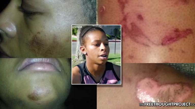 Cops Mistake Small Teen Girl for Large Adult Male, Beat & Sic K9 on Her