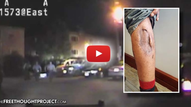 WATCH: Dept Releases Video of K9 Removing "Hunks of Flesh" from Innocent Man As Cops Kick Him