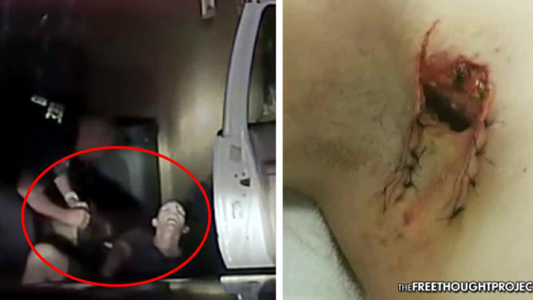 Disturbing Video Shows Cops Force K9 to Maul Man for Not Getting Out of Car Fast Enough
