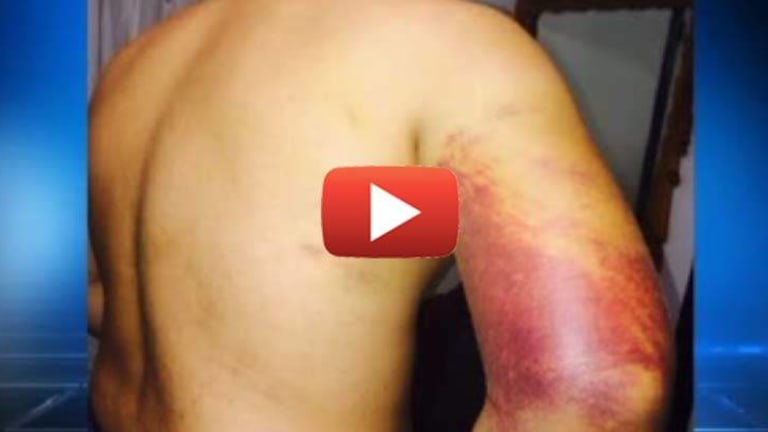 School Cop Brutally Beat a 16-Year-Old Boy for Using Profanity