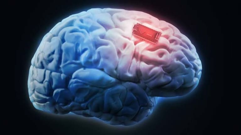 A Third of U.S. Adults Say They'd Be 'Enthusiastic' About Having a Microchip Implanted in Brain