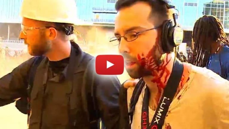 VIDEO: Police Throw Stun Grenades Into Crowd, Ripping a Journalist's Face Open