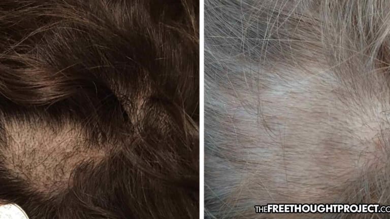 Parents Outraged After School Shaved Large Patches of Hair from Kids' Heads to Drug Test Them