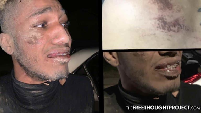 Cops Accuse Man of Stealing His Own Car, Beat the Hell Out of Him, Then Let Him Go
