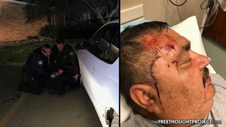 Native American Man Misses Mother's Last Moments Because Cops Beat Him at Hospital