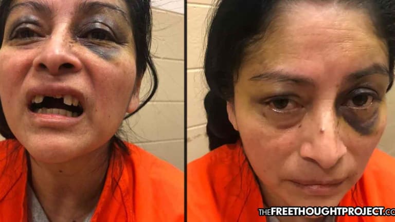 Cops Knock Innocent Mother's Teeth Out as She Held Toddler, Beat Her for Filming Them