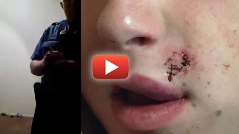 Disturbing Video Shows NJ Cops Tear Open Teen's Face for Not Giving them His Name