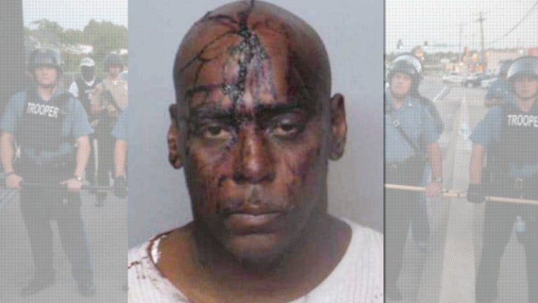 Ferguson Police Beat This Innocent Man Bloody - Then Charged Him For Getting Blood On Their Uniforms