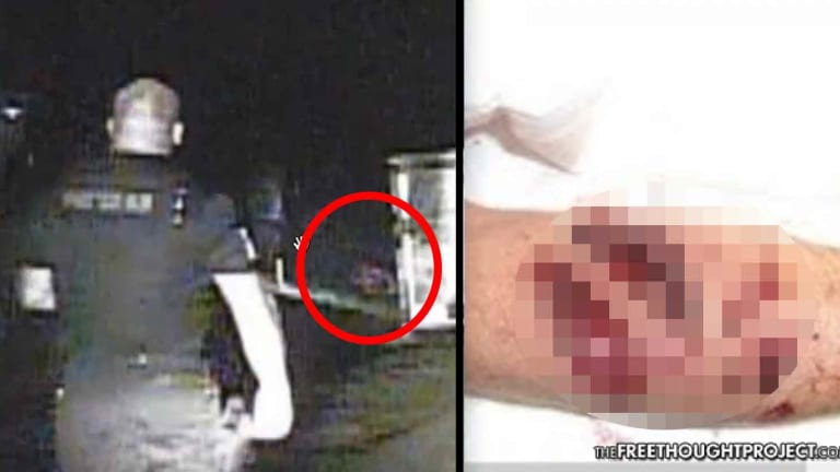 Cops Tried to Hide This Video Showing Them Taser Man, Knock Him Out, Force K9 to Maul Him