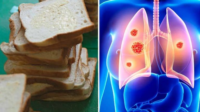 Study: Eating White Bread & Bagels Can Be Worse than Smoking - 49% Increase in Lung Cancer