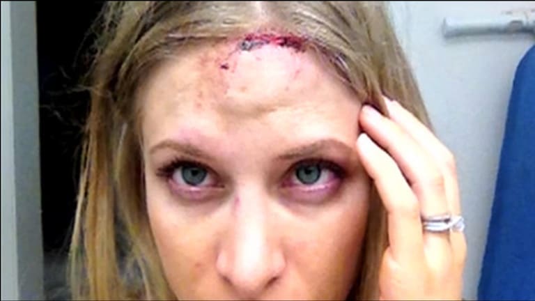 Austin Police Beat Woman During SXSW Then Lied About It, Victim Claims