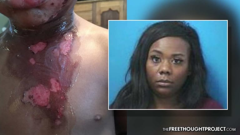 Toddler Suffers Disfiguring Burns at Police Station After Mom Jailed for Traffic Violations