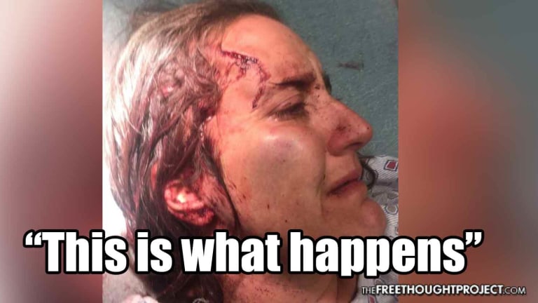 Cop Smashes Handcuffed Woman's Head In, Photographs Her Injuries And Brags to His Friends