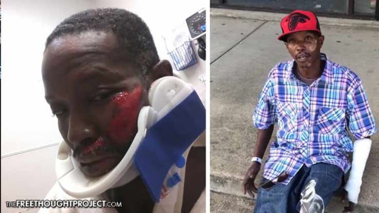 Innocent Man Left Permanently Disfigured After Cop Allegedly Attacked Him for No Reason