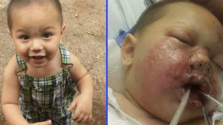 Baby Critically Burned During SWAT Raid, Stun Grenade Thrown into His Crib.