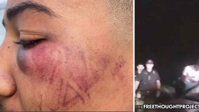 WATCH: Teen Beaten So Violently, Cops Left a Boot Imprint on His Face—Over Speeding Ticket