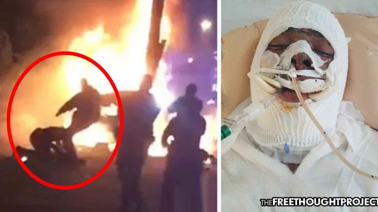 NO JAIL for Cops Who Set an Innocent Man on Fire and Savagely Beat Him