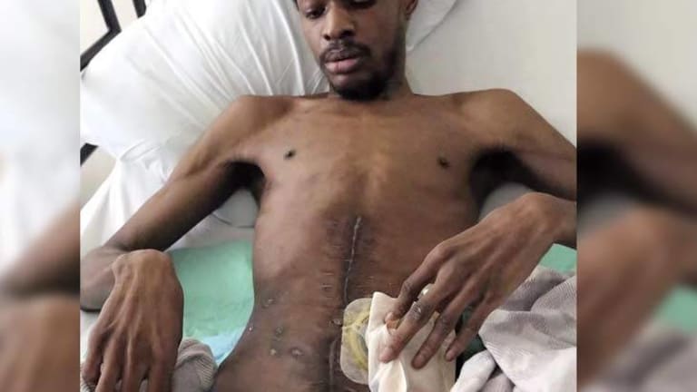Man Left Paralyzed After Militarized Police Filled Him With Bullet Holes for 8 Ounces of Weed