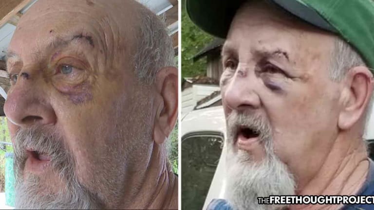 Great-Grandpa Left Permanently Injured After Cops Beat Him Bloody in Wrongful Raid—Lawsuit