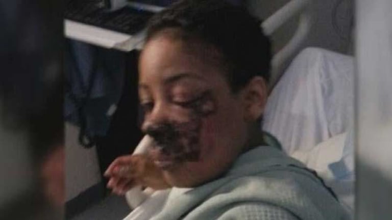 Teen Girl Left with Broken Bones, Missing Teeth After Cops Stopped Her for Having a Conversation