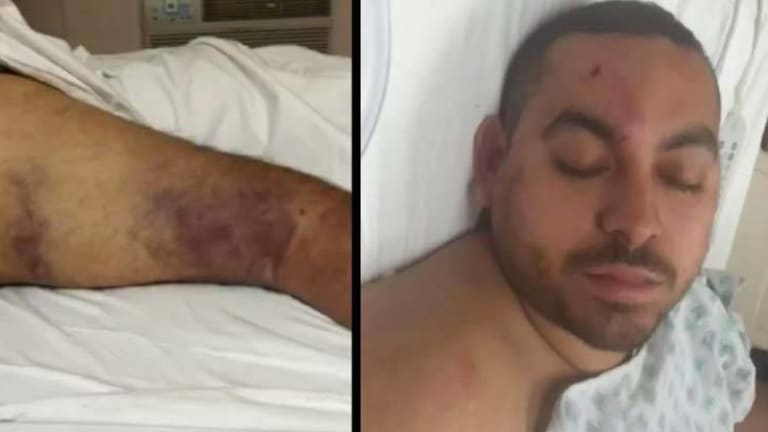 Cops Mistake Innocent Man's Seizure for a Crime, Beat Him So Bad He Was Hospitalized for Days