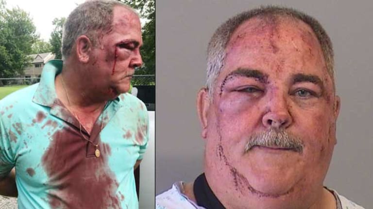 Cops Go Onto Innocent Man's Property, Beat Him to a Pulp, Charge HIM with a Felony