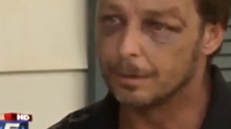 Father Calls 911 because his Son just Killed Himself, Police Show up and Beat and Arrest Him