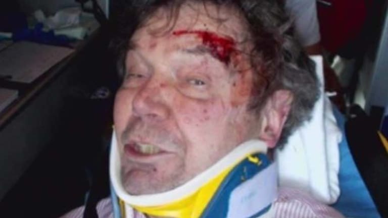 Elderly Man With Alzheimer's in ICU after Cops Brutally Beat Him for Breaking Into His Own House