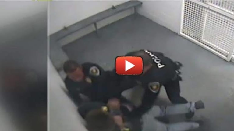 Video Exposes Lying Cops After they Break Handcuffed Man's Skull Open & Claim he Did it to Himself