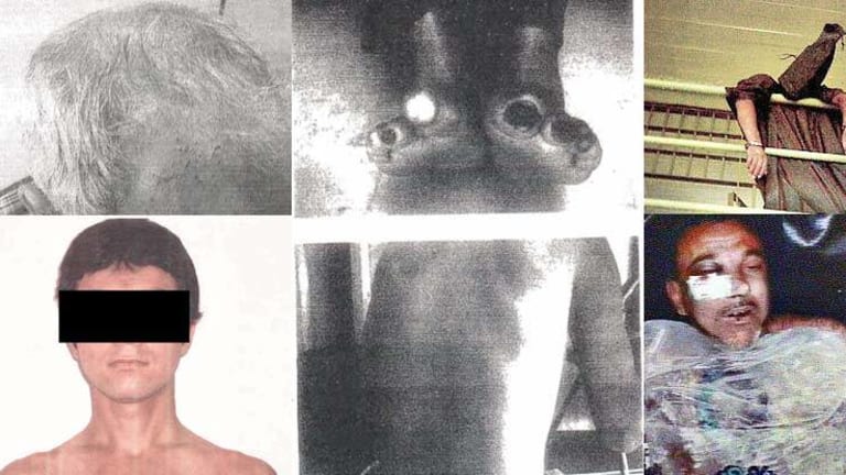 Pentagon Just Released Photos of Tortured Prisoners, You Won't Believe What they Left Out
