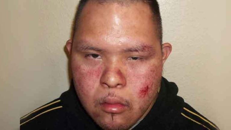 Police Admit Fault for Beating & Kidnapping Man with Down Syndrome, Refuse to Apologize