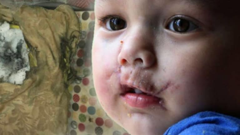 New Low: Sheriff's Office Claims Infant at Fault for SWAT Team Blowing His Face Apart with Grenade
