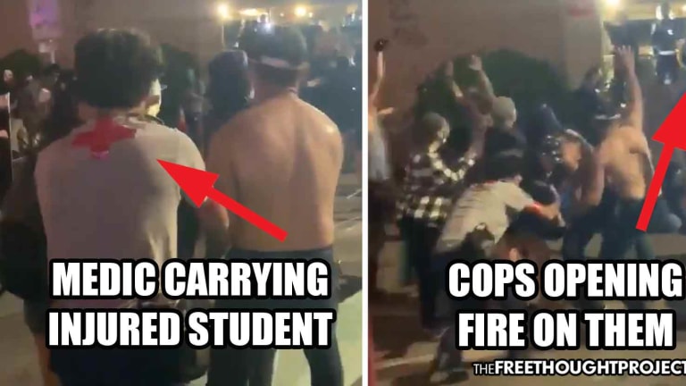 WATCH: Cops Shoot Innocent Student in Head with Rubber Bullet, Open Fire on People Helping Him