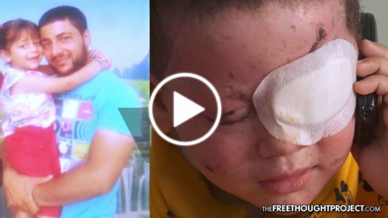 Heartbreaking Video of 4yo Girl Who Survived US Airstrikes Proves It's Not 'Our Freedom they Hate'