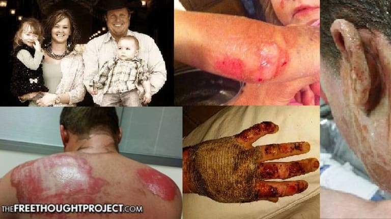 Fracking Found Responsible for Blast that Severely Burned Entire Family - No One Charged