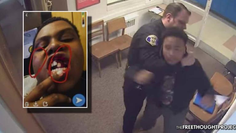 Horrifying Video Shows School Cop Beat Up Boy for No Reason, Knock His Teeth Out