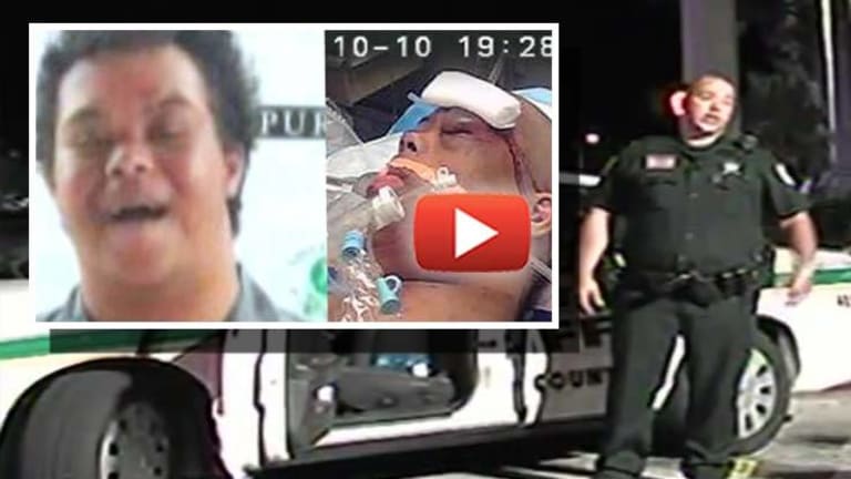 Sheriff Exposed as Liar by Fellow Cop in the Shooting of an Unarmed Down Syndrome Child