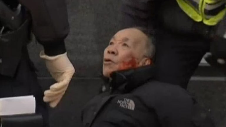 84 Year-old Man Left Beaten and Bloodied by NYPD for Jaywalking