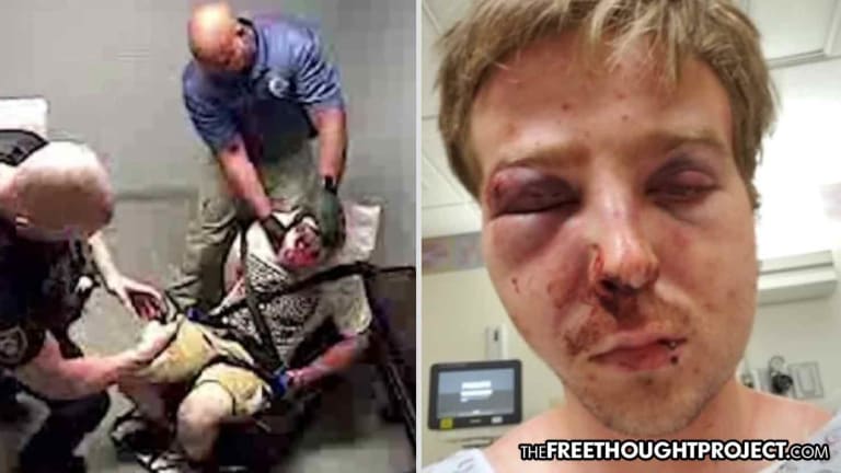 WATCH: Cops Literally Break College Student's Face Then Take Trophy Photos