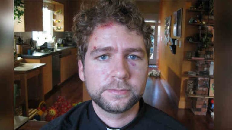 Pastor Files Federal Civil Rights Lawsuit After Being Brutally Beaten by Police