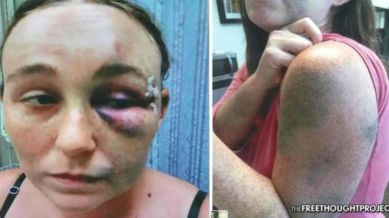 Cops Brutally Attacked Woman One Week After She Testified Against an Officer - Lawsuit