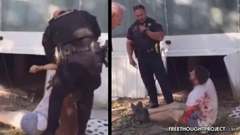 WATCH: Innocent Man Mauled Nearly to Death As Cops Sic K9 on Him with No Warning