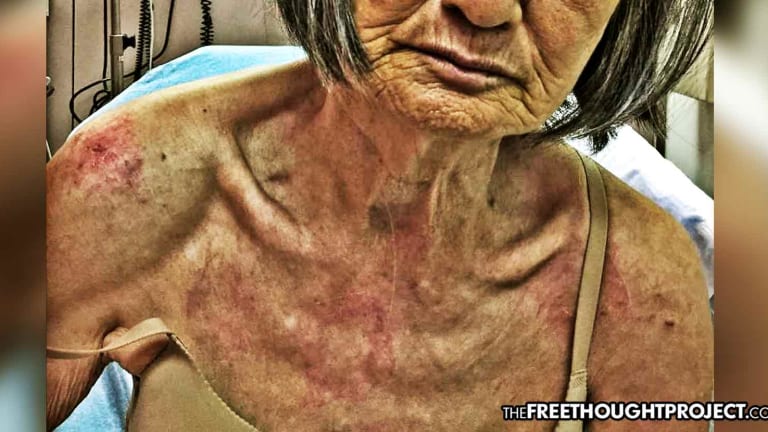 Deaf 76-year-old Woman Knocked Unconscious and Arrested Over Alleged Jaywalking