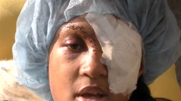 Pregnant Woman Loses Eye After St. Louis Cops Shoot Her With Bean Bag Through Her Car Window