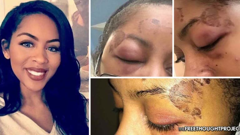 Woman Allegedly Pulled From Car, Severely Beaten by Police for Sleeping in Passenger's Seat
